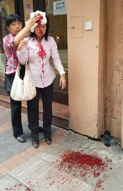 Eine Freundin versucht, die Blutung an Liao Qiulans Kopf zu stoppen, nachdem sie am 24. September 2019 in Hongkong von zwei Gangstern angegriffen wurde.