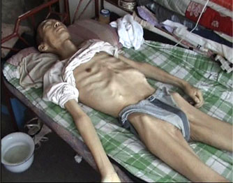 Der von Folter ausgemergelte Li Wanjun, kurz vor seinem Tod.