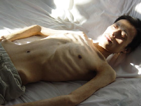 Der ausgemergelte Körper von Zhang Zhong nach Folter im Juli 2004. Zhang starb am 16. Oktober 2006 an den Folgen weiterer Misshandlungen.