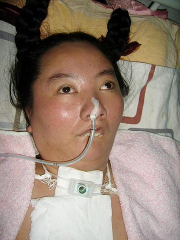Luftröhrenschnitt und Magensonde über die Nase - aufgrund von brutaler Folter in einem chinesischen Arbeitslager musste Li Huiqi die letzten Jahre ihres kurzen Lebens unendliches Leid ertragen.